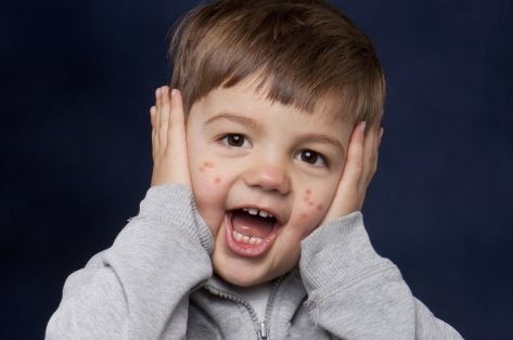 Сыпь у ребенка: лечим кожу снаружи и изнутри